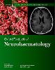 Oxford Textbook of Neurohaematology