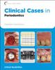 Clinical Cases in Periodontics