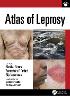 Atlas of Leprosy