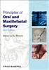 Principles of Oral and Maxillofacial Surgery
