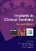 Implants in Clinical Dentistry