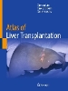 Atlas of Liver Transplantation