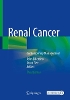 Renal Cancer