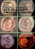 3D Ultrasound in Prenatal Diagnosis