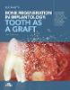 Bone regeneration in implantology - tooth as a graft