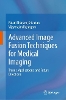 Advanced Image Fusion Techniques for Medical Imaging